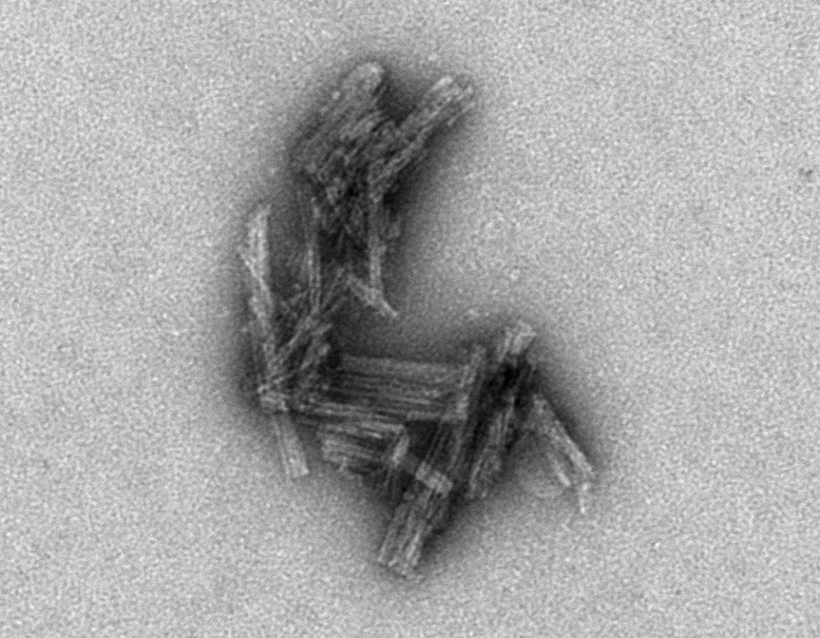 Clusters of tau protein under an electron microscope